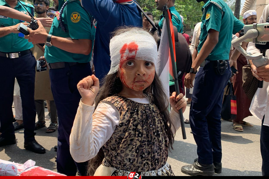 হাতে ফিলিস্তিনি পতাকা, মুখে রক্তের ছাপ, মাথায় ব্যান্ডেজ, হাজারো ফিলিস্তিনি শিশুর প্রতীক হয়ে জনতার মাঝে এক শিশু