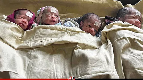চমেক হাসপাতালে একসঙ্গে ৪ শিশুর জন্ম