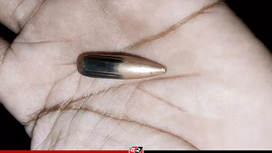 মিয়ানমার থেকে ছোড়া গুলিতে বাংলাদেশি নারী আহত