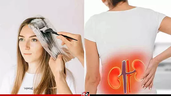 চুলে রঙে লুকিয়ে কিডনি বিকলের আশঙ্কা