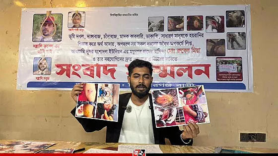 মাছের ঘের দখলের চেষ্টায় সন্ত্রাসী হামলার অভিযোগ ভুক্তভোগীর