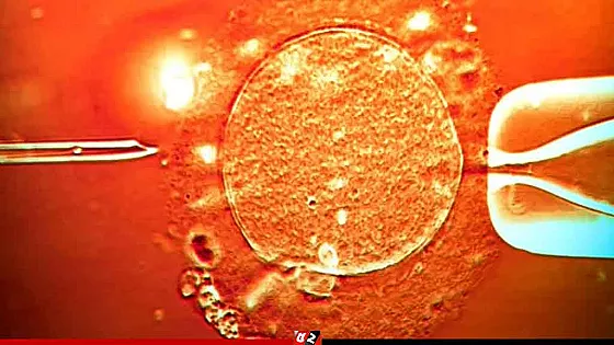 শুক্রাণু দাতার জিনে ক্যানসার সৃষ্টিকারী উপাদান, জন্ম নিয়েছে ১৯৭ শিশু