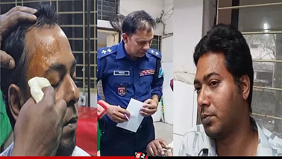 পাগলা মসজিদে সংবাদ সংগ্রহ করতে গিয়ে আহত দুই সাংবাদিক