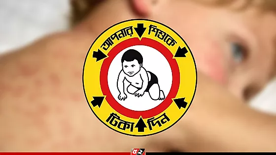 হামের বিশেষ টিকাদান কর্মসূচি শুরু 