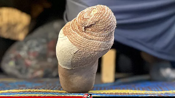 ইঁদুরের তাণ্ডবে অতিষ্ঠ গাজাবাসী, বাড়ছে ভয় ও অসহায়ত্ব