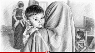 হাম ও উপসর্গে আরও ৫ শিশুর মৃত্যু