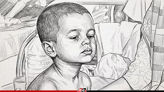 একদিনে হামের উপসর্গে আরও ৭ শিশুর মৃত্যু