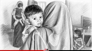 হামের উপসর্গে আরও ৭ শিশুর মৃত্যু, হাসপাতালে ভর্তি ৭৩১