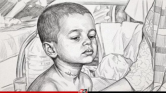 একদিনে হামের উপসর্গে আরও ১১ শিশুর মৃত্যু, হাসপাতালে ১০৬৮