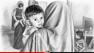 একদিনে হামের উপসর্গে আরও ৯ শিশুর মৃত্যু, হাসপাতালে ১৩৪১