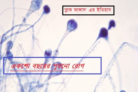 ‘ব্লাক ফাঙ্গাস’ এর ইতিহাস: একশো বছরের পুরনো রোগ (ভিডিও)