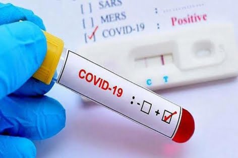 চট্টগ্রামে গেলো ২৪ ঘণ্টায় ৯ জন করোনা আক্রান্ত