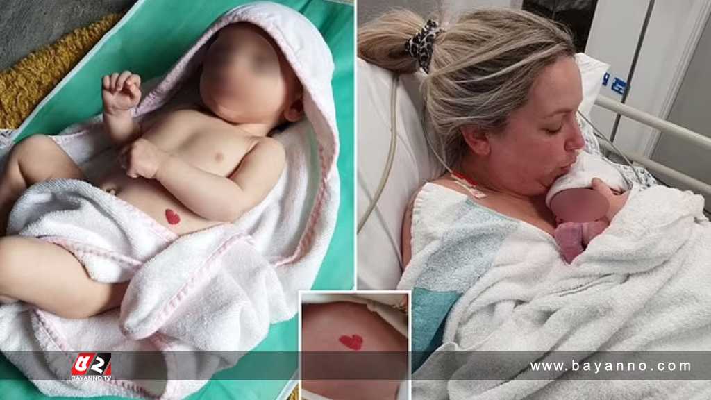 শিশুর জন্মদাগ দেখে অবাক চিকিৎসকও! জন্মদাগ