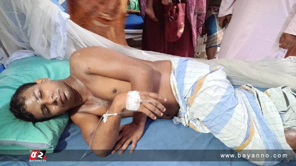 গরম তেল ঢেলে দোকানদারের শরীর ঝলছে দিল মাদকসেবী